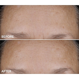 DermInfusions™ - Produs de ingrijire hidratant si reparator
