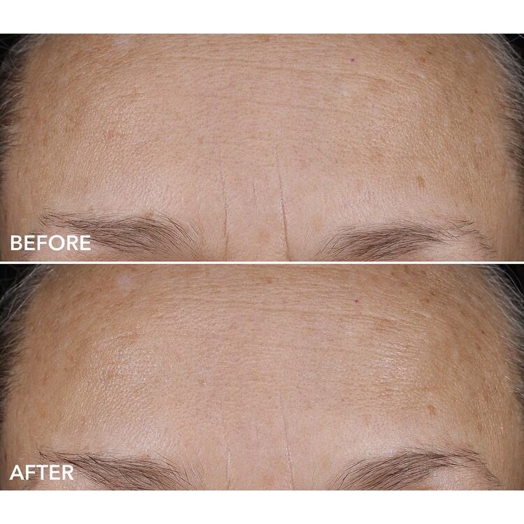 DermInfusions™ - Trattamento idratante levigante e riparatore