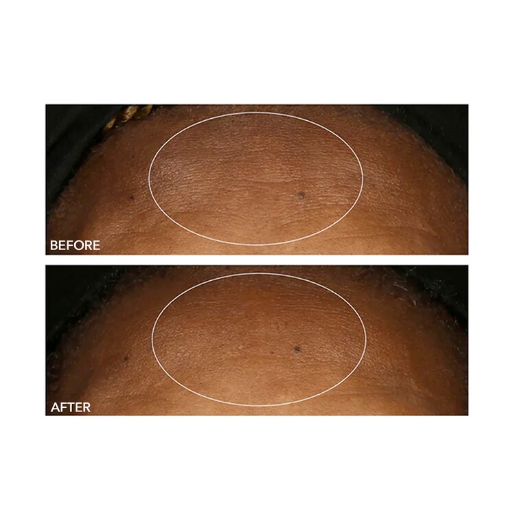 Alpha Beta® - Peeling Diário Fórmula Universal