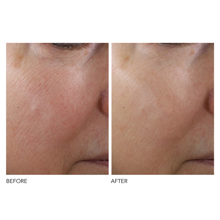 Advanced R + F Texture Renewal - Serum