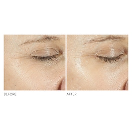 Advanced R + F Triple Correction - Eye Serum
