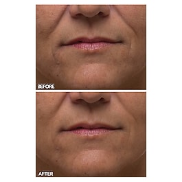 Alpha Beta® - Peeling quotidiano ultra delicato