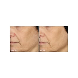 Vitamin C + Lactic - Serum mit 15% Vitamin C Straffung und Strahlkraft