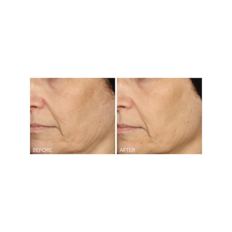 Vitamin C + Lactic - Sérum Concentré 15% de Vitamine C Fermeté et éclat