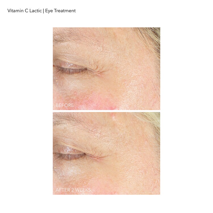 Vitamin C Lactic - Περιποίηση Λάμψης Περίγραμμα Ματιών
