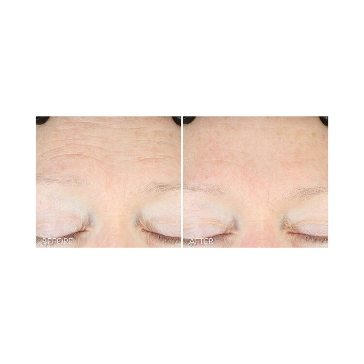 Vitamin C + Lactic - Sérum Tratamiento Hidratante