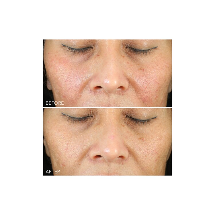 Vitamin C + Lactic - Sérum Tratamiento Hidratante