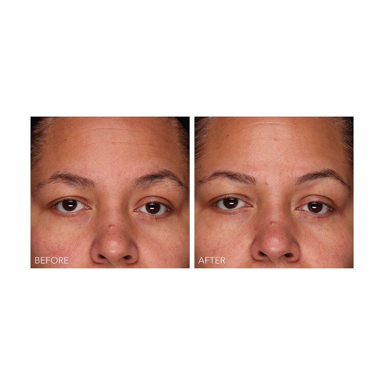 DermInfusions - Gel Régénération Rapide