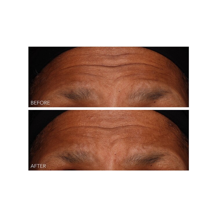 DermInfusions - Gel Régénération Rapide