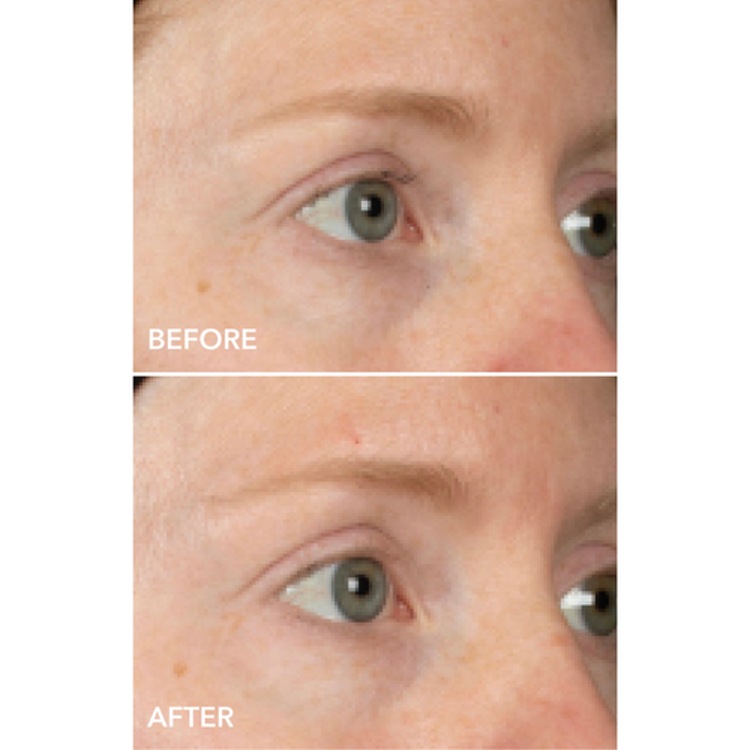 DermInfusions - Masque Contour des Yeux Liftant + Régénérant