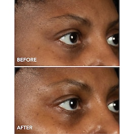 DermInfusions - Maschera Contorno Occhi Liftante + Rigenerante
