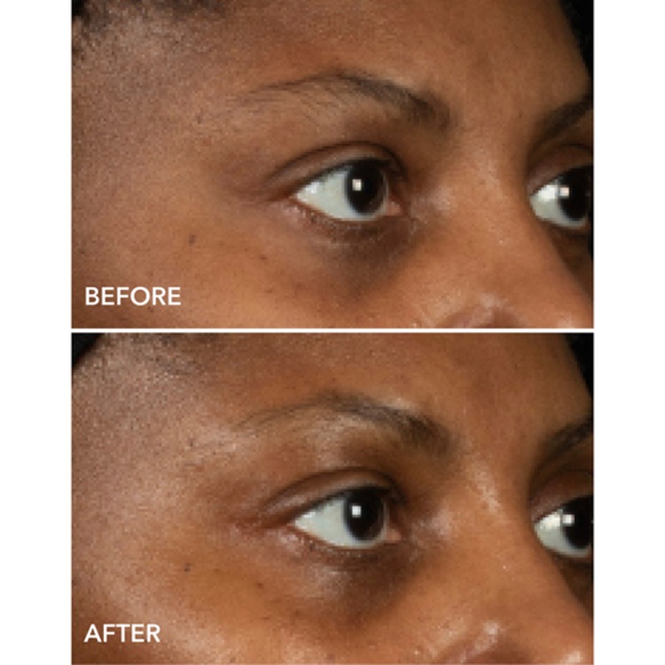 DermInfusions - Masque Contour des Yeux Liftant + Régénérant