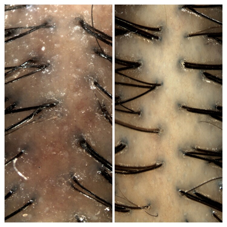 Amino™ - durulanmayan saç derisi bakım köpüğü