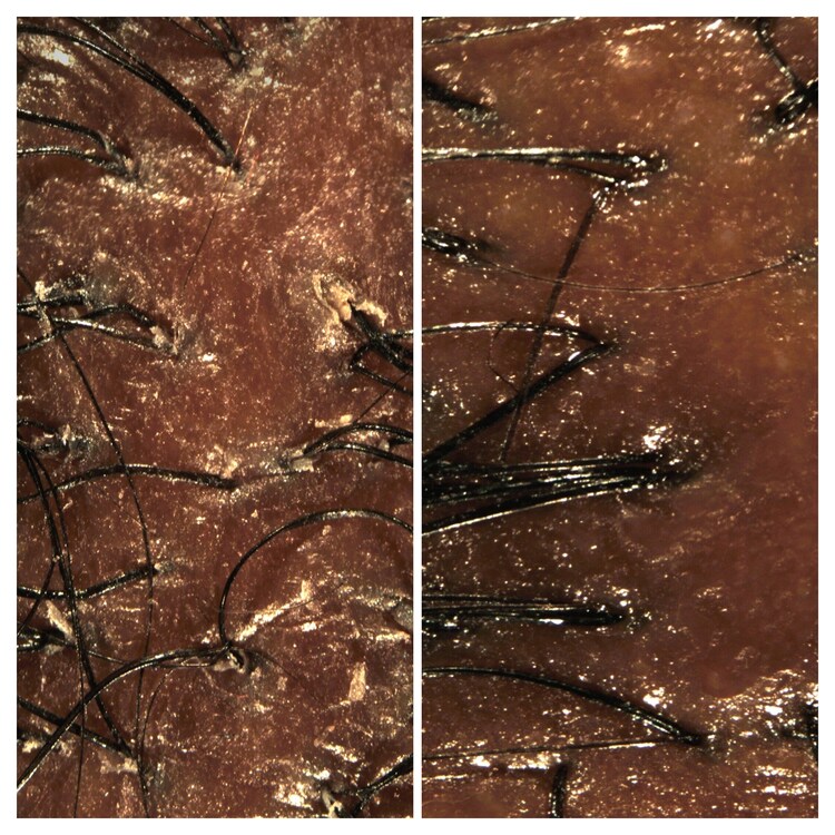 Amino™ - durulanmayan saç derisi bakım köpüğü