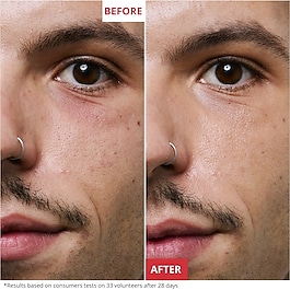 Skin Therapy Light - Multi-perfecting night serum