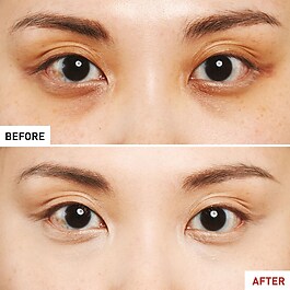 Super BB Concealer – Yüksek kapatıcılığa sahip kapatıcı + etkili bakım