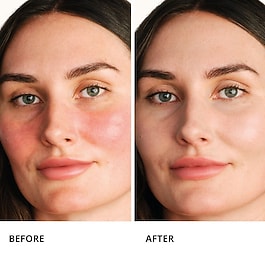 Centella Red Serum - Koncentr&aacute;t s okamžit&yacute;m zklidňuj&iacute;c&iacute;m &uacute;činkem