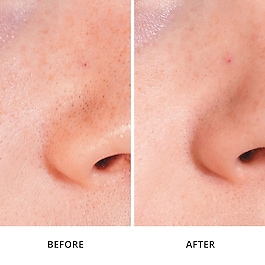 Ginseng micro shot 0.1 - S&eacute;rum micro-infusion retexturant