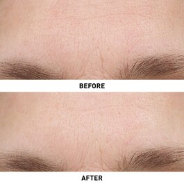 Ginseng Micro Shot 0.3 - S&eacute;rum intensivo de micro-infus&atilde;o retexturizante