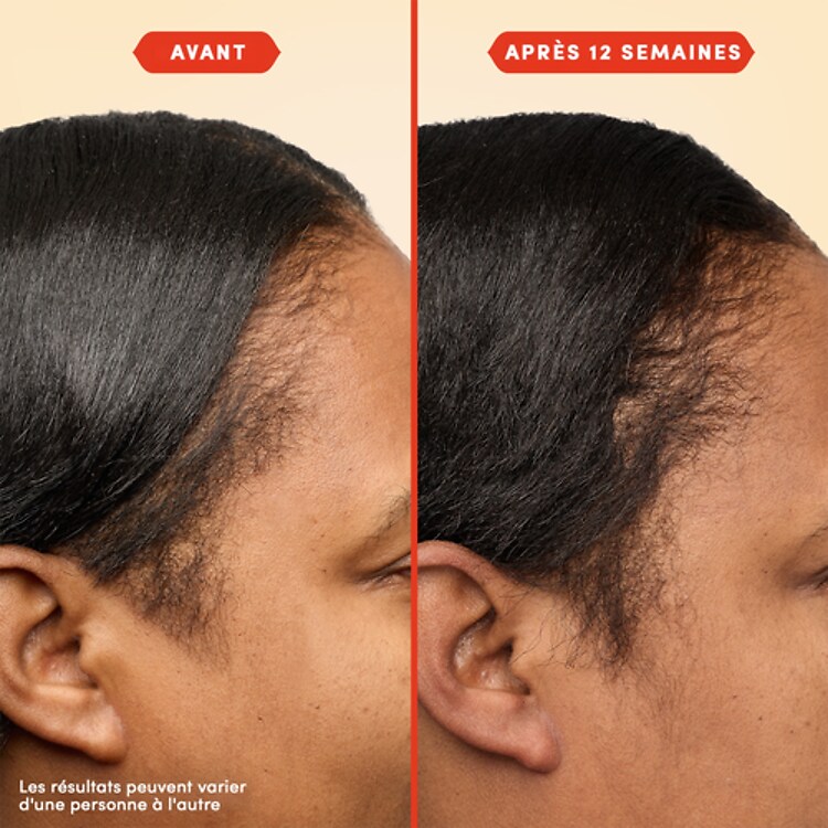 HoliRoots - Huile capillaire pour cheveux renforcés