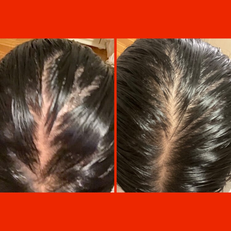 HoliRoots - Huile capillaire pour cheveux renforcés