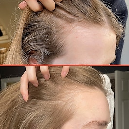 HoliRoots™ Hair Oil - Olio trattante prelavaggio fortificante 