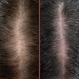 HoliRoots™ Hair Oil - Olio trattante prelavaggio fortificante 