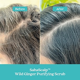 SahaScalp™ Scalp Reset Kit - Set pentru par