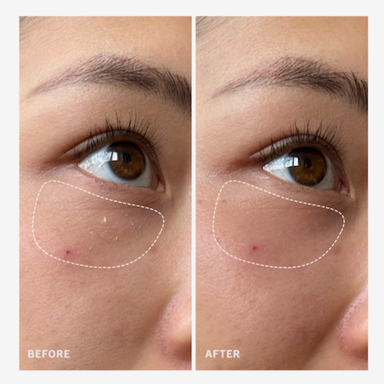 Ultra Repair Rescue Balm - Baume de Secours Ultra Réparateur au Diméthcone 