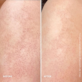 Smooth + Juicy Scrub Kit -Zestaw do peelingu ciała na rogowacenie okołomieszkowe