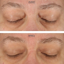 FAB-Skin Lab Retinol & Hyaluronic Acid Eye Cream