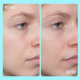 10% Vitamin C Brightening Serum - Sérum Illuminateur avec 10% de Vitamine C 