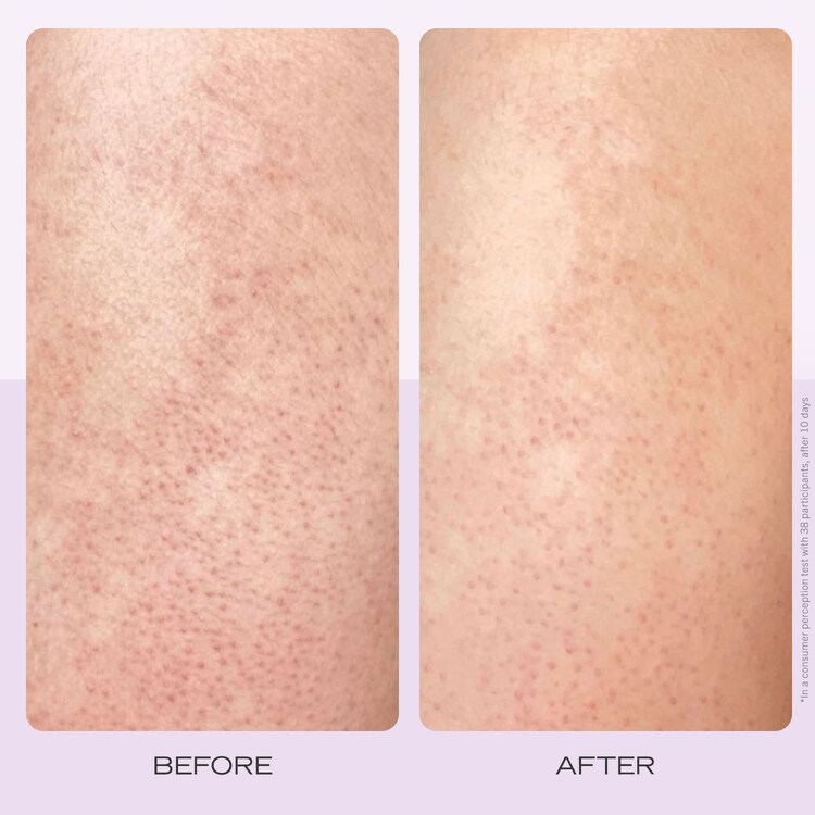 KP Body Scrub Strawberry - Bodyscrub med AHA Jordbærduft Omgående virkning