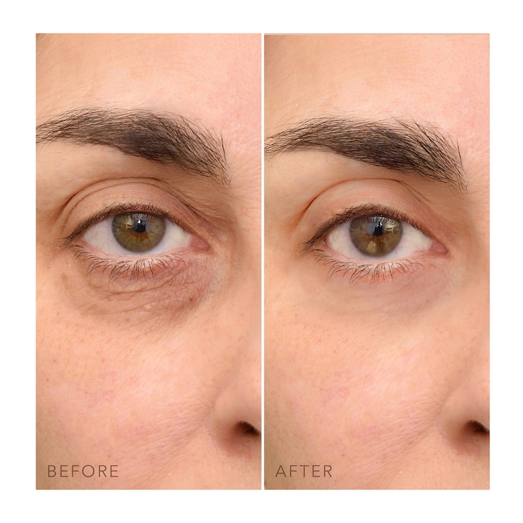 IRIS™ C-Concentrated Brightening Eye Cream - Skoncentrowany krem pod oczy 