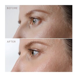 IRIS™ Firming PM Eye Serum - Ujędrniające serum z retinolem pod oczy na noc 