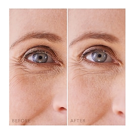 Iris™ Hydrating Hydrogel Eye Mask