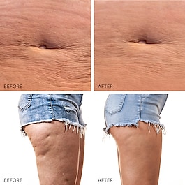 FOREO BEAR™ 2 body Fullkropps Mikroström Toningsapparat