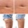 BEAR™ 2 body - Mikroprądowe urządzenie ujędrniające do ciała