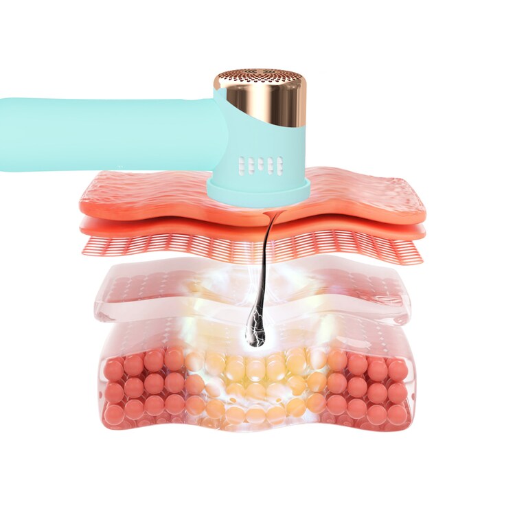 PEACH™ 2 go - przyjazne w podróży urządzenie IPL do trwałej redukcji owłosienia