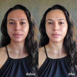LUNA ™ Fofo - Dispositivo de belleza facial