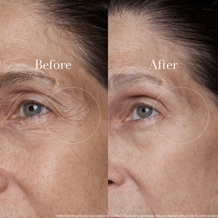 Black Tea Age Renewal Eye Concentrate – Crème des yeux anti-âge au thé noir