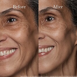 Black Tea Age Renewal Eye Concentrate – Przeciwdziałający starzeniu krem