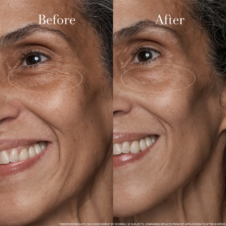 Black Tea Age Renewal Eye Concentrate – Crème des yeux anti-âge au thé noir