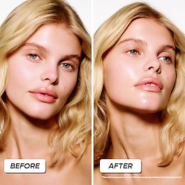 Sunkiss Remedy - Cr&egrave;me gel&eacute;e ultra-fra&icirc;che repulpante