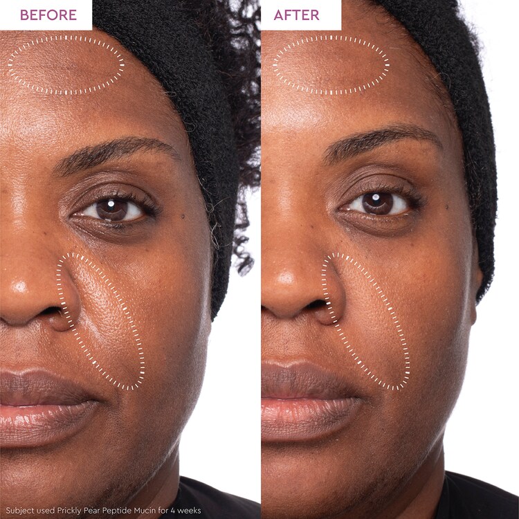 PRICKLY PEAR - Siero viso con mucina peptidica