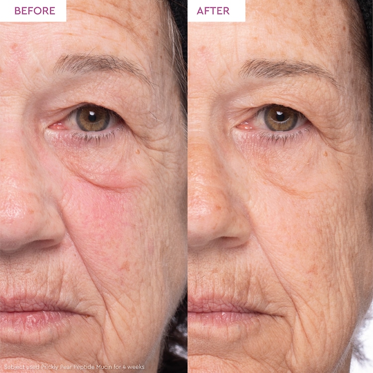 PRICKLY PEAR - Siero viso con mucina peptidica