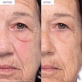 PRICKLY PEAR - Peptit Müsini İçeren Yüz Serumu