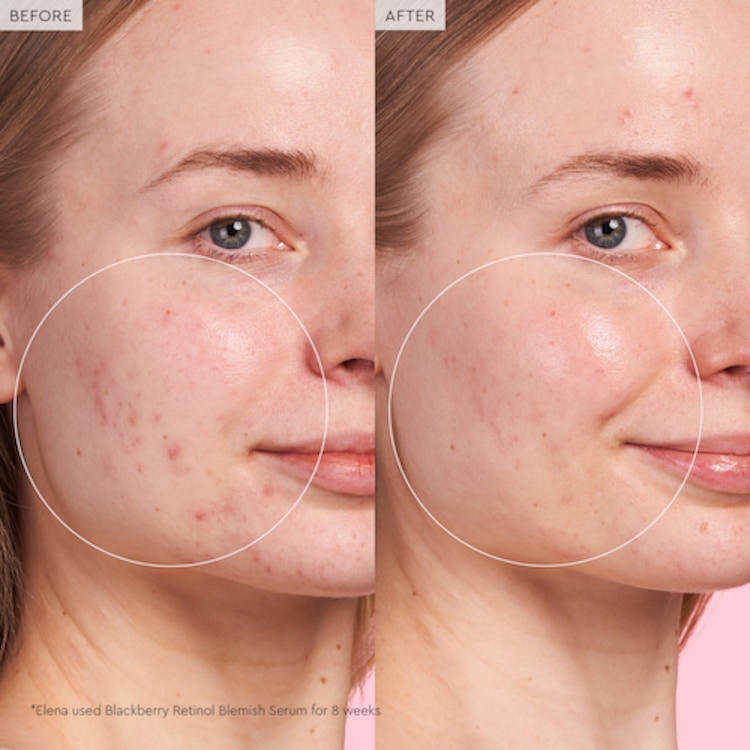 Blackberry Retinol - Sérum de réinitialisation