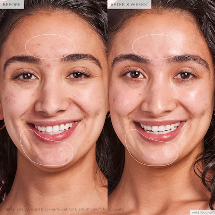 Blackberry Retinol - Sérum de réinitialisation