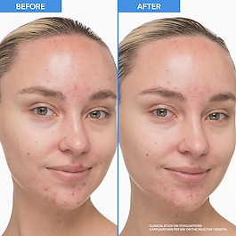 Ser de corp delicat cu retinol si acid salicilic -  anti-imperfectiuni